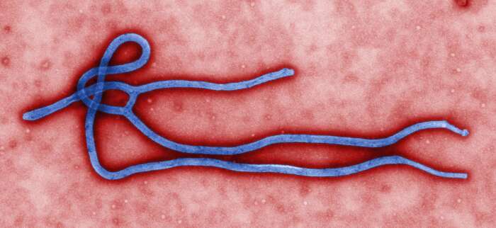 Ebola é descartado em paciente vindo de Uganda; exame confirma malária, informa Fiocruz